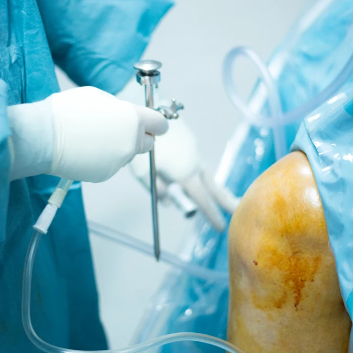 hospital-con-servicios-de-artroscopia