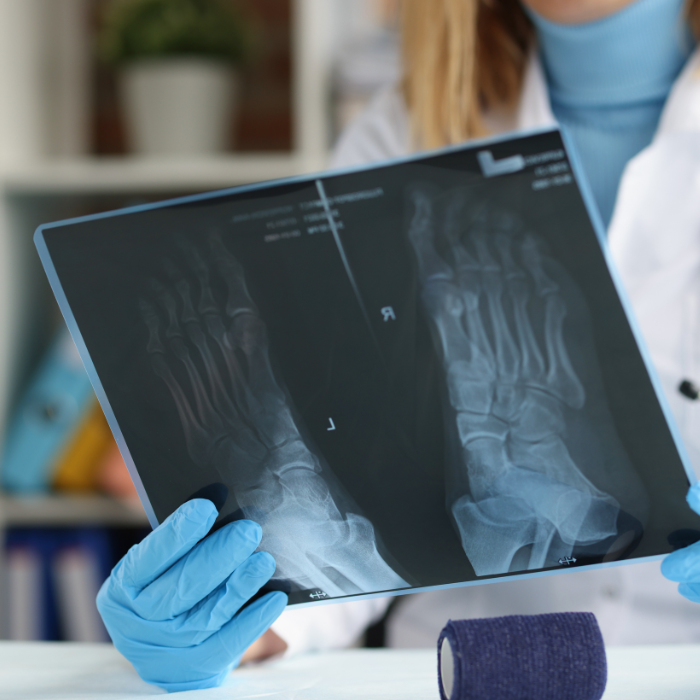 traumatologo-en-tlalnepantla